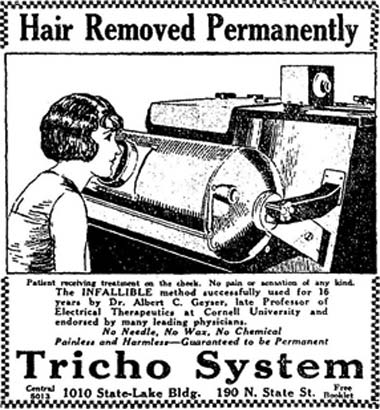 Удаление волос с помощью рентгеновских лучей: популярнейший способ эпиляции прошлого столетия